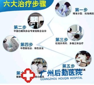 广州白癜风