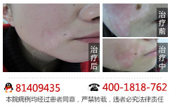 白癜风到底怎样进行检查