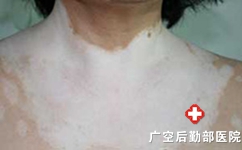 红枣味汤圆对患者是否有益